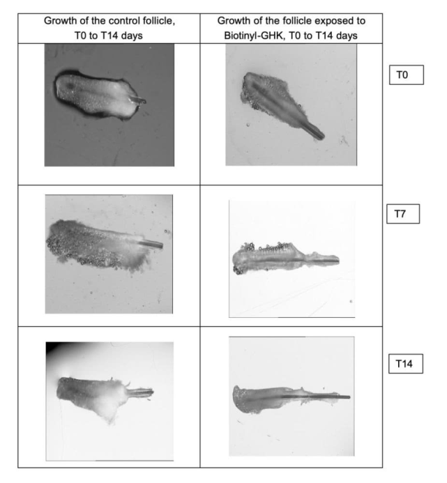 9种不同的肽如何在生发中深入毛囊发挥作用？Decapeptide-10